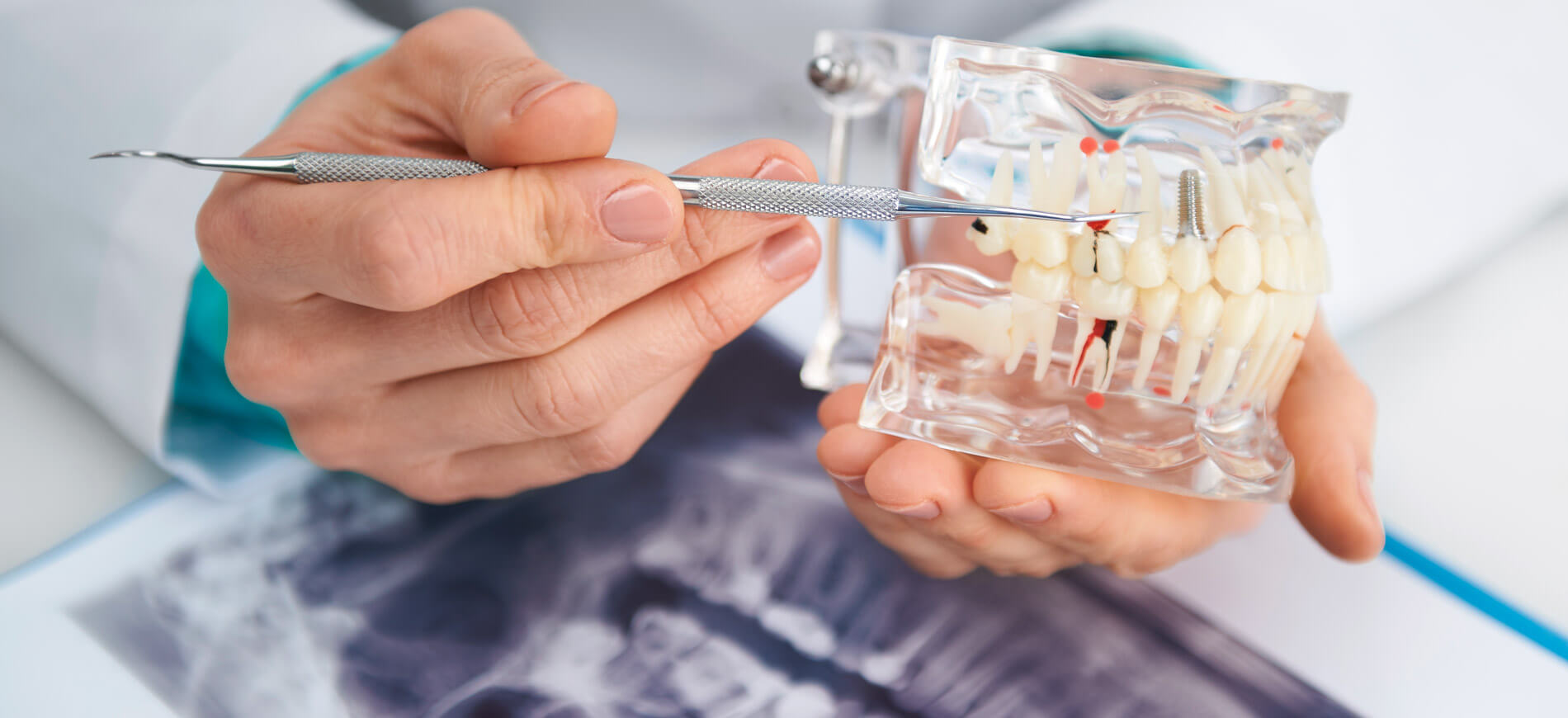 Cele mai frecvente 5 interventii de chirurgie dentara